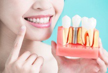 person pointing to their smile while holding dental implants in West Palm Beach 