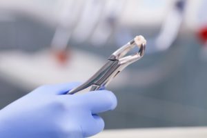A dentist holding a tooth with dental forceps.