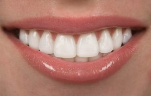 woman smiling with beautiful teeth