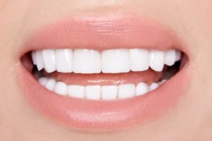 person with porcelain veneers smiling